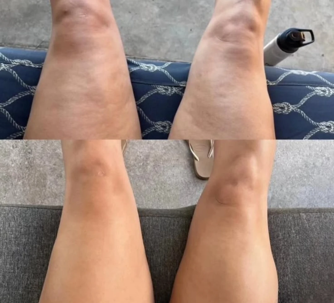 LipoSculpt customer review
